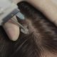 repousse-cheveux-mesotherapie